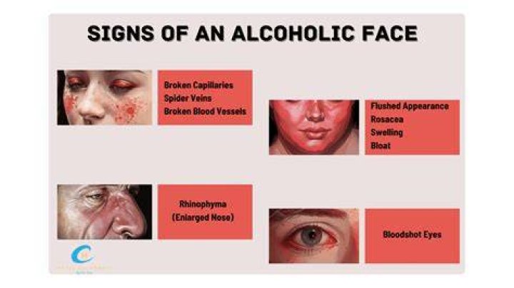 Can alcohol cause dark spots on skin?