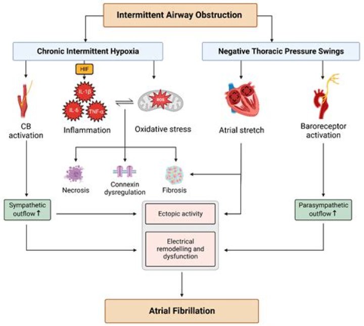 Can too much sleep cause AFib?