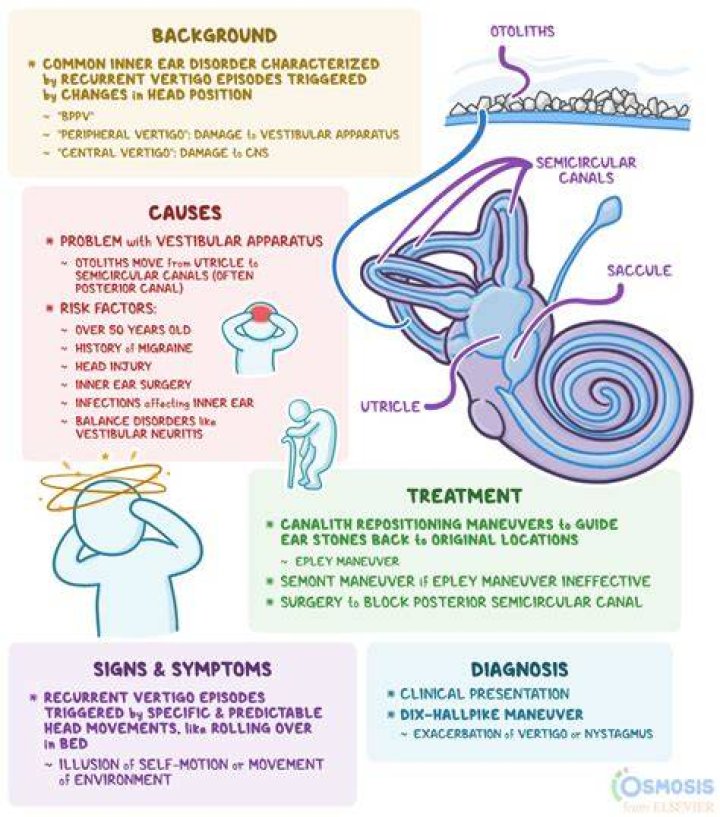 Can vertigo cause hoarseness?