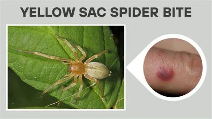 Do yellow sac spiders bite multiple times?