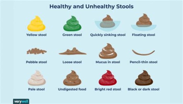 Does formula poop smell bad?