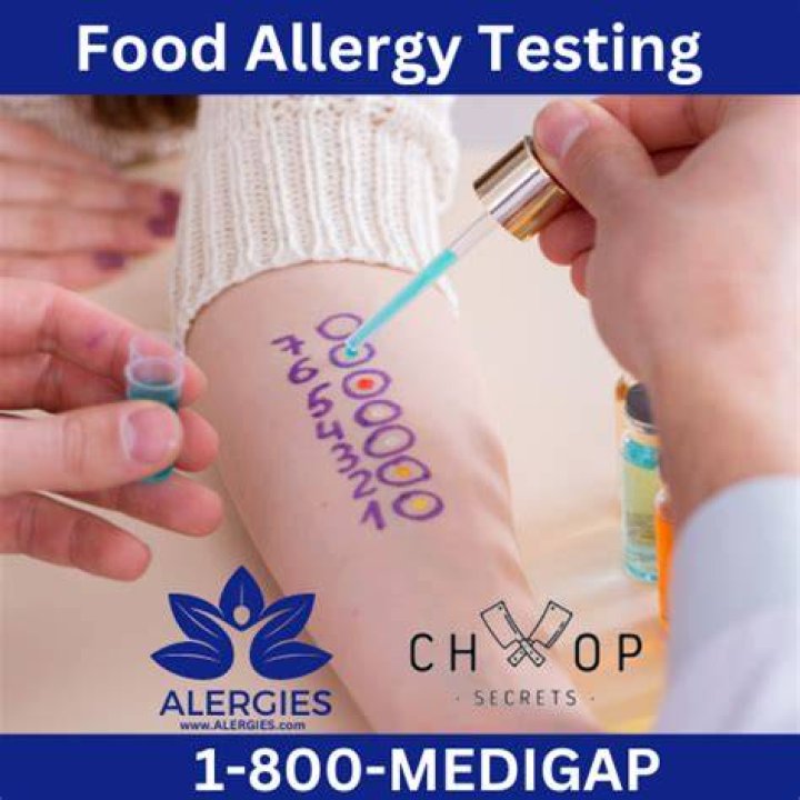 Does insurance cover food allergy testing?