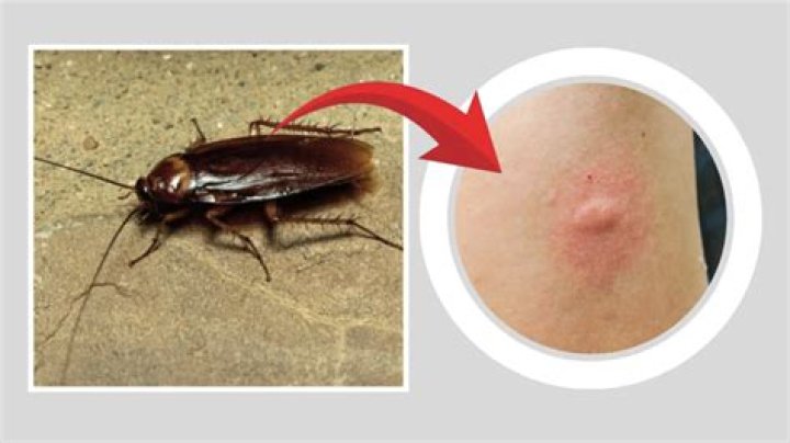 Does small cockroach bite?
