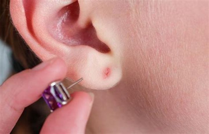 How do you treat an infected ear piercing on a child?