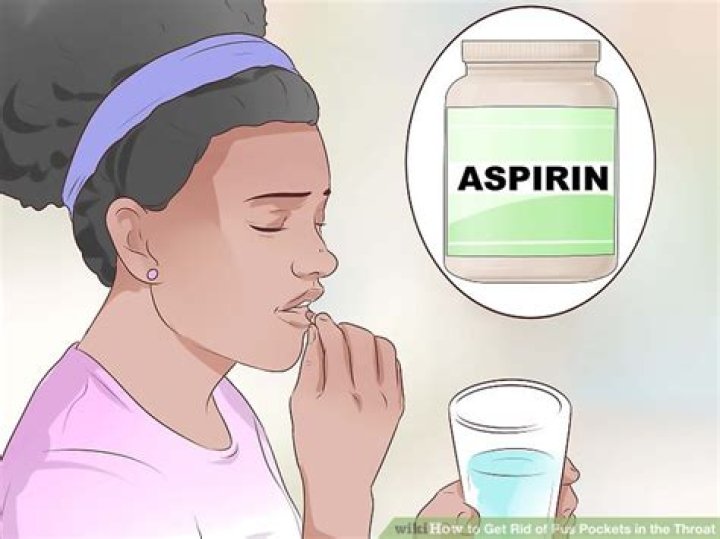 How do you treat pus in the throat?