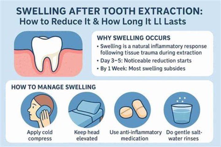 How long does facial swelling last after tooth extraction?