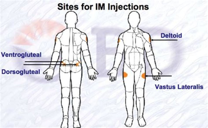 How many ml Can you give IM in Dorsogluteal?