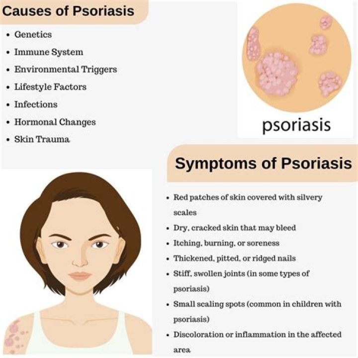How serious is psoriasis of the liver?
