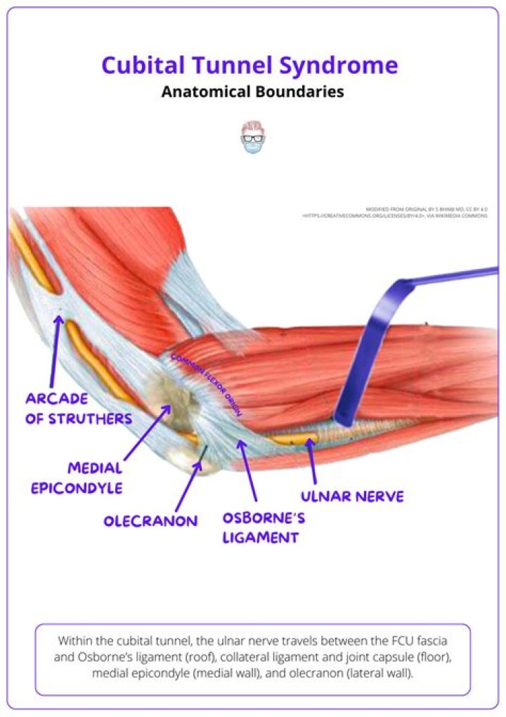 Is cubital tunnel release surgery painful?