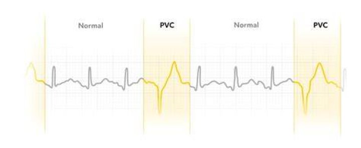 What are PVCs used for?