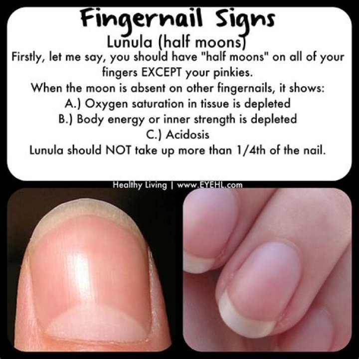 What does it mean if you have no half moons on your fingernails?