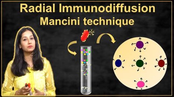 What is radial immunodiffusion technique?