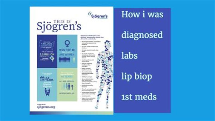 What lab tests for sjogrens?