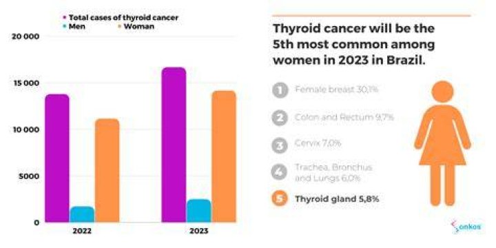 What percentage of biopsied thyroid nodules are cancerous?