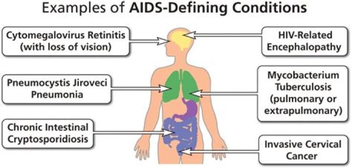 What prophylactic treatments should be used at this time to prevent the development of opportunistic diseases?