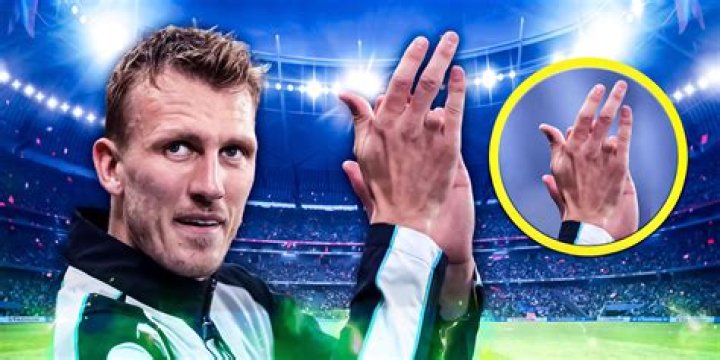 Who lost their finger in the NFL?