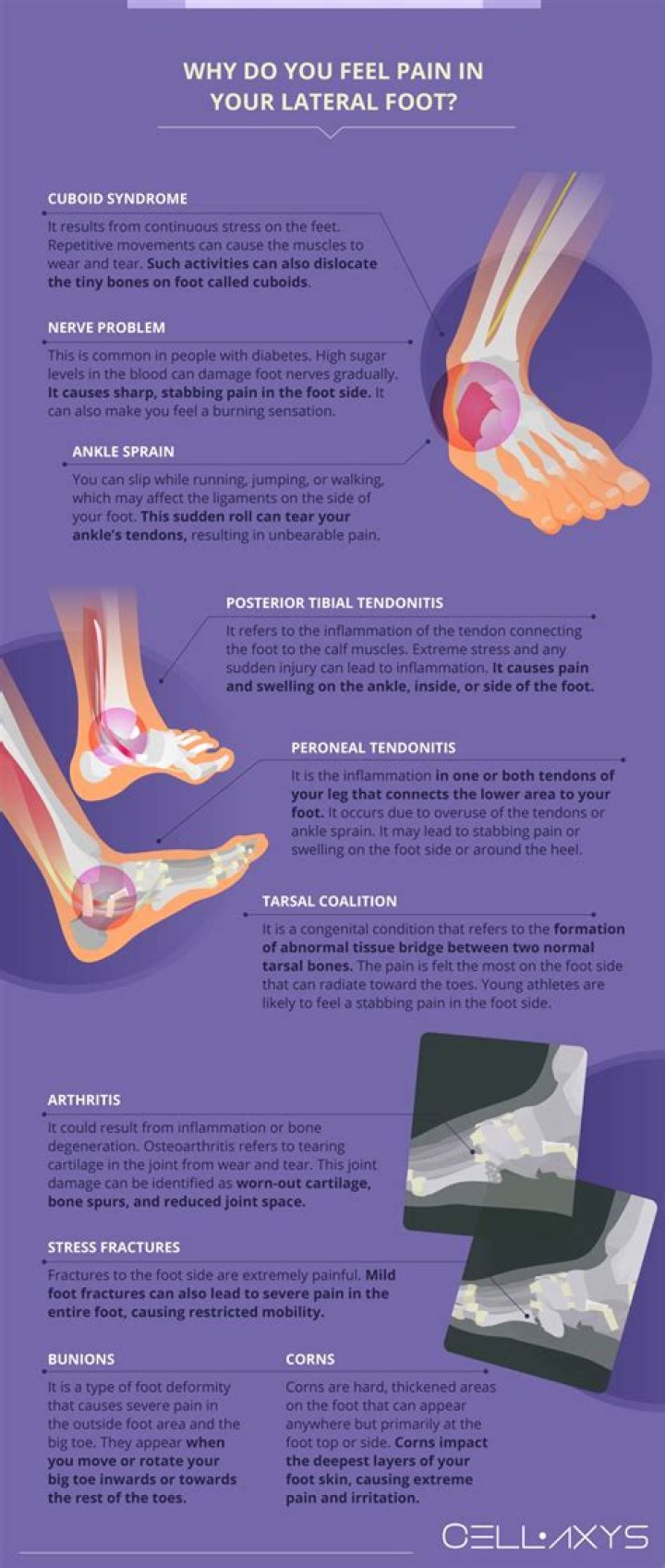 Why does my foot hurt worse after a cortisone shot?